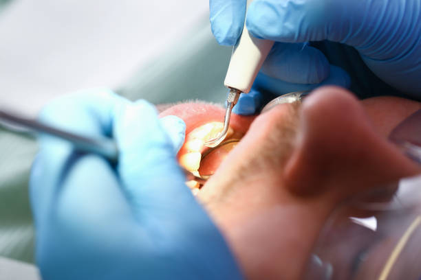 Best Emergency Dental Care for Abscessed Tooth in Park Ridge, IL